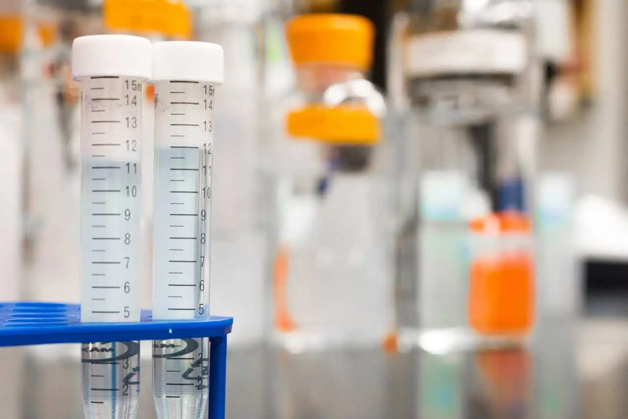 Precise laboratory test tubes filled with liquids in a modern medical laboratory setting.